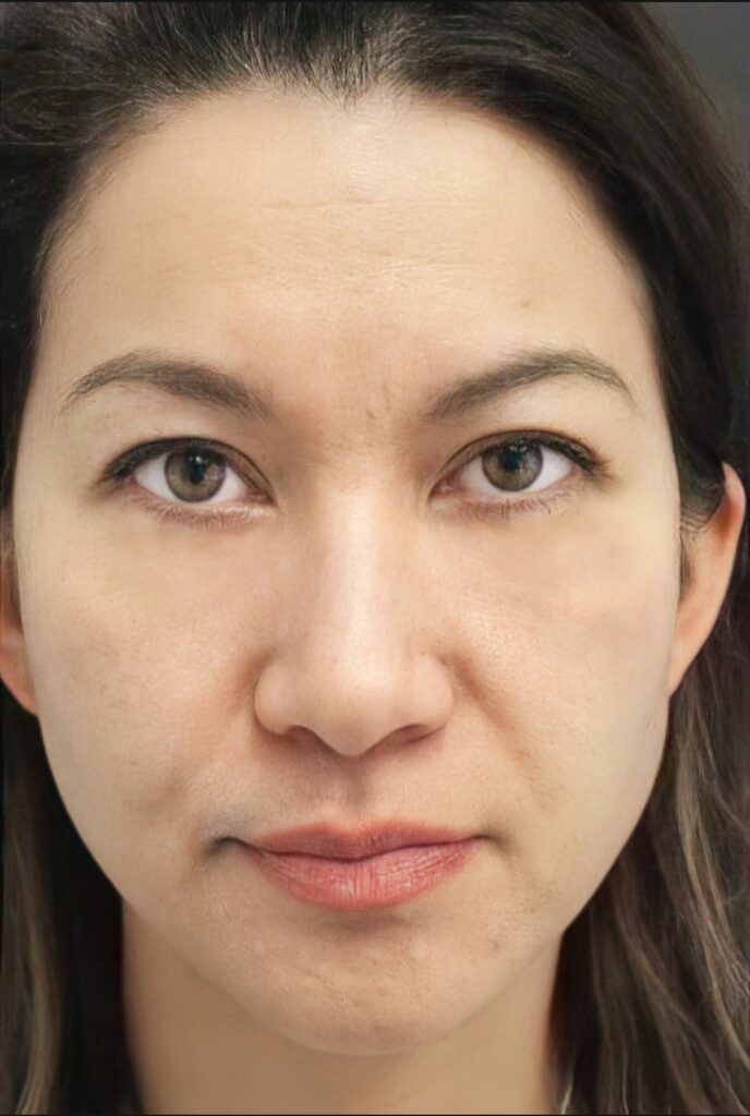 How to Remove Eye Bags Fabulously in Photo for Free